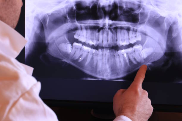 Best Emergency Dental Care for Abscessed Tooth in Nederland, CO