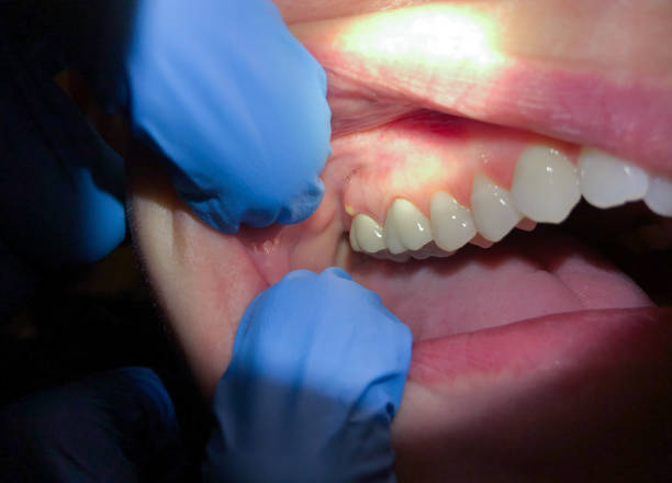 Best Emergency Dental Services for Seniors in Nederland, CO